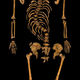 Illustration for article titled Tényleg gerincferdülése volt III. Richárdnak, de púpos az nem volt